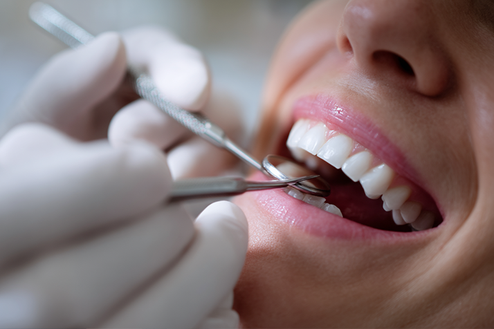 Dental Implants and Sedation